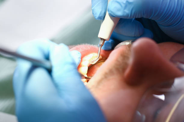 Best Emergency Cosmetic Dentistry (e.g., broken veneers) in Mill Hall, PA