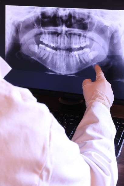 Best Emergency Treatment for Oral Infections in Mill Hall, PA