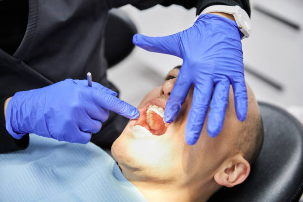 Best Emergency Wisdom Tooth Extraction in Mill Hall, PA